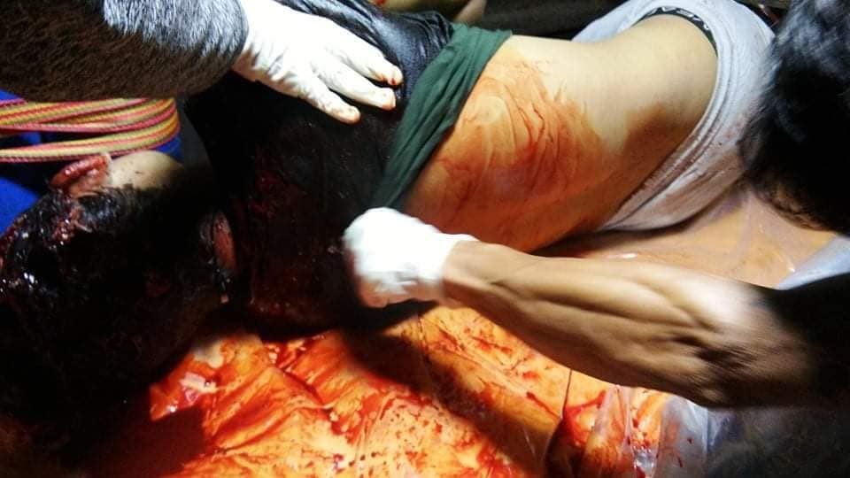 hannayuri_twt's tweet photo. Tw // Death 🥀

A man on a motorcycle was shot dead by the junta's armed forces at the Myanmar Ward Office in Hsipaw, Northern Shan State, around 9:30 PM  on June 23.

#June23Coup #WhatsHappeningInMyanmar https://t.co/yYW71feLSR