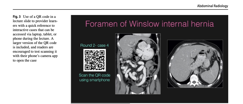 Michael Hartung (@drmhartung) on Twitter photo Calling all radiology educators!
Check out pubmed.ncbi.nlm.nih.gov/34086093/
My favorite interactive tools <a href="/pacsbin/">Pacsbin.com</a> <a href="/Radiopaedia/">Radiopaedia.org</a> <a href="/HorosProject/">Horos Project</a>, QR codes.
Congrats co-authors <a href="/markdsugi/">Mark D. Sugi</a> <a href="/DrVikasShah/">(𝚝𝚑𝚎𝚡𝚛𝚊𝚢𝚍𝚘𝚌𝚝𝚘𝚛)</a> <a href="/tabby_kennedy/">Tabby A. Kennedy, MD</a>!
#radiology <a href="/frankgaillard/">Frank Gaillard</a> <a href="/RSNA/">RSNA</a> <a href="/cookyscan1/">Cooky Menias</a> <a href="/UCSFimaging/">UCSF Imaging</a> <a href="/UWiscRadiology/">UW Radiology</a> Calling all radiology educators!
Check out pubmed.ncbi.nlm.nih.gov/34086093/
My favorite interactive tools <a href="/pacsbin/">Pacsbin.com</a> <a href="/Radiopaedia/">Radiopaedia.org</a> <a href="/HorosProject/">Horos Project</a>, QR codes.
Congrats co-authors <a href="/markdsugi/">Mark D. Sugi</a> <a href="/DrVikasShah/">(𝚝𝚑𝚎𝚡𝚛𝚊𝚢𝚍𝚘𝚌𝚝𝚘𝚛)</a> <a href="/tabby_kennedy/">Tabby A. Kennedy, MD</a>!
#radiology <a href="/frankgaillard/">Frank Gaillard</a> <a href="/RSNA/">RSNA</a> <a href="/cookyscan1/">Cooky Menias</a> <a href="/UCSFimaging/">UCSF Imaging</a> <a href="/UWiscRadiology/">UW Radiology</a>