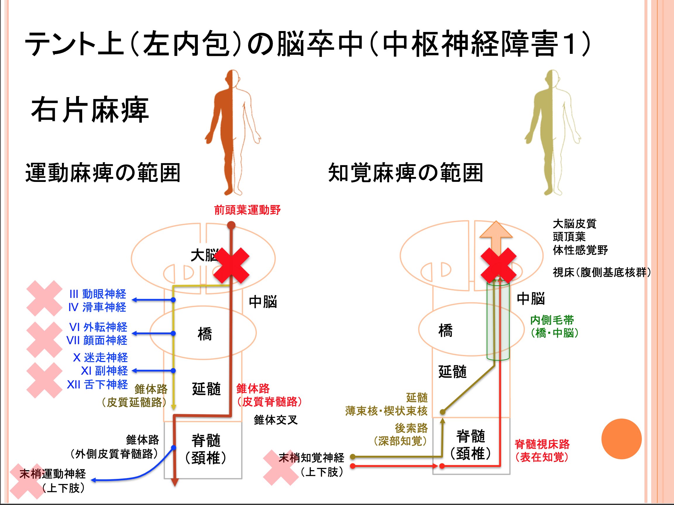 Oj On Twitter 運動 感覚障害１ テント上 左内包 運動麻痺 顔面を含む右上下肢 知覚障害 顔面を含む右上下肢 Https T Co Rpatxm8x0x Twitter