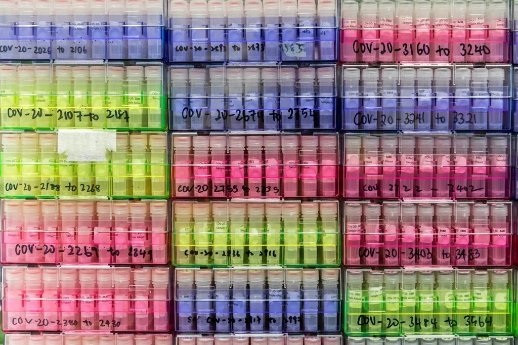 A coronavirus variant first spotted in India is poised to become the dominant one in the United States.
"This is the most transmissible of all the variants that we've seen," Dr. Peter Hotez, dean of the National School of Tropical Medicine at Baylor College of Medicine