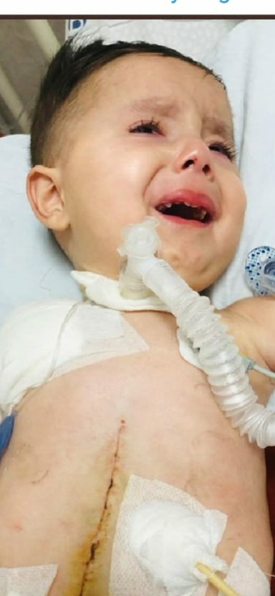 furkansmatip's tweet photo. Kardeşlerim günlerimiz azalıyor. Son 63 gün.. Kampanyamız haftada 0.50 ilerlemiyor. Neden oğlumu gören susuyor 😔her gören 10 TL bile atsa oğlum kurtulur. Onu da yapamıyorsanız rt yapın ki bağış yapanlar görsün bizi. Lütfen oğlumu kurtarın ölüme terk etmeyin

#Dolunay Sınava 2 https://t.co/GZgoleOqEM