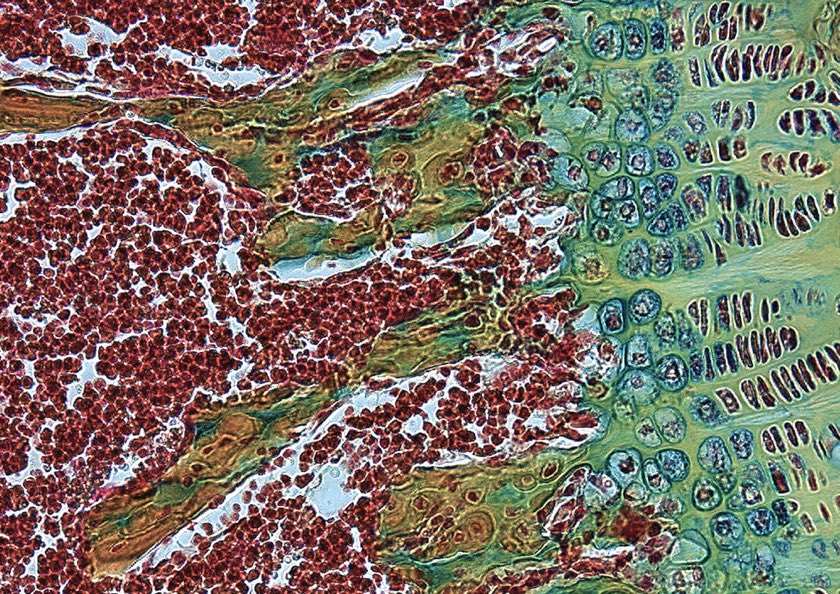 Philipp Leucht, MD (@philippleuchtmd) on Twitter photo Opening in the Leucht lab <a href="/nyulangone/">NYU Langone Health</a> for an enthusiastic postdoc to study bone aging&repair as part of a highly collaborative team.Bringing exciting new technologies to the lab that will form the basis of this project!Contact us for more info <a href="/NYC_Postdoc/">NYC Postdoc Coalition</a> <a href="/ORSsociety/">Orthopaedic Research Society</a> <a href="/ASBMR/">ASBMR</a> Opening in the Leucht lab <a href="/nyulangone/">NYU Langone Health</a> for an enthusiastic postdoc to study bone aging&repair as part of a highly collaborative team.Bringing exciting new technologies to the lab that will form the basis of this project!Contact us for more info <a href="/NYC_Postdoc/">NYC Postdoc Coalition</a> <a href="/ORSsociety/">Orthopaedic Research Society</a> <a href="/ASBMR/">ASBMR</a>