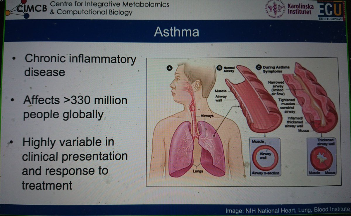 jjjvanderhooft's tweet photo. It's my pleasure to listen to @StaceyReinke Dr Stacey Reinke during #MetSoc2021 @MetabolomicsSoc @EMN_MetSoc! 😎 Stacey enlightens us about #asthma and #metabolomics: towards a better understanding of #metabolic #pertubations during asthma and the effects of medication! https://t.co/5iCUbEqCk3
