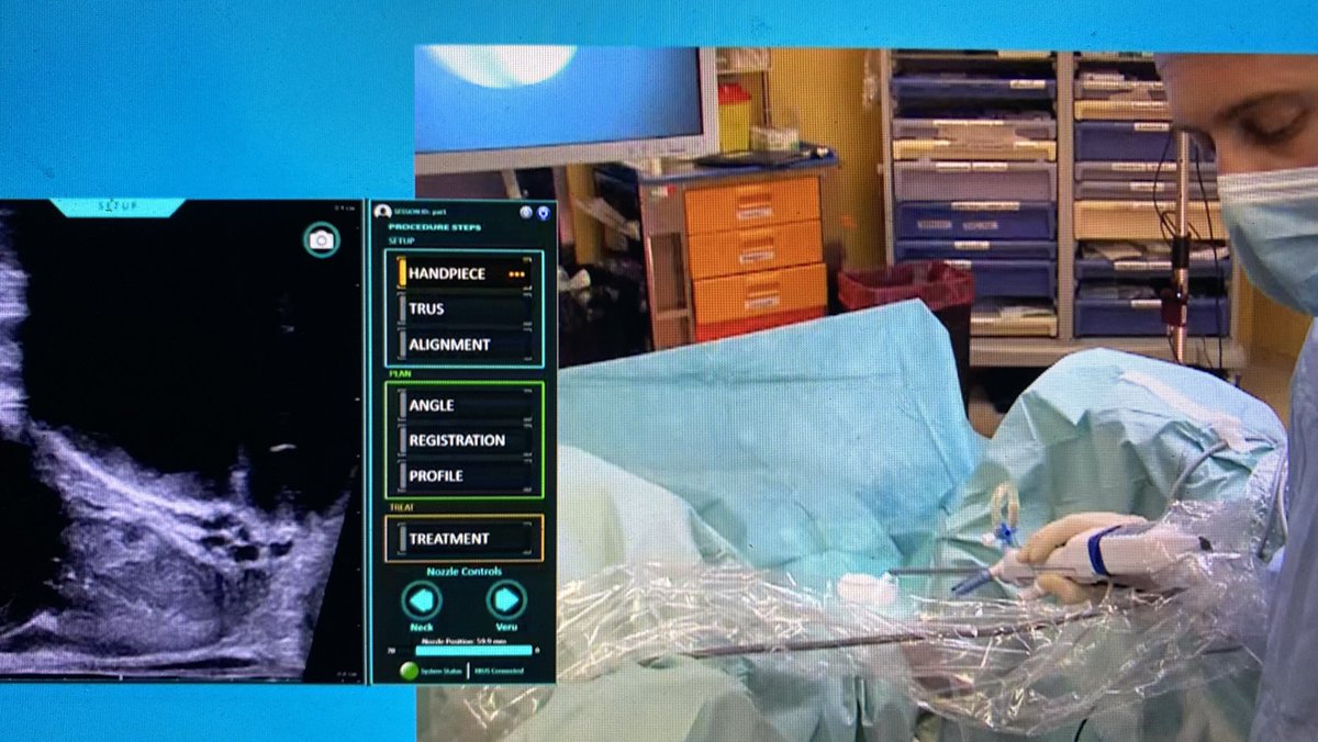 andrea_cocci's tweet photo. #SIULIVE21 idroablazione robotica per #ipertrofia #prostatica con risparmio dell’eiaculazione #aquabeam #firenze #ipertrofiaprostatica #waterject https://t.co/6SfUNdba6C