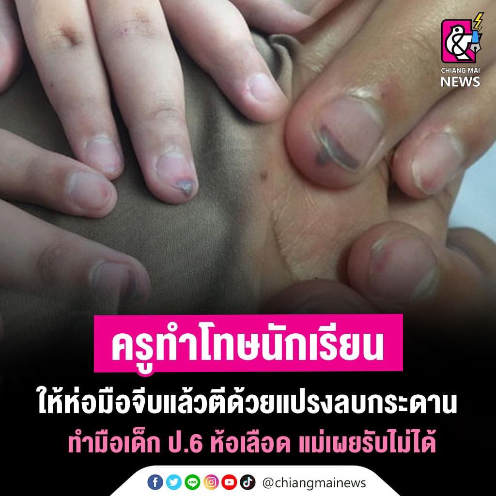 ซึมเศร้าเพื่อนรัก. tweet media