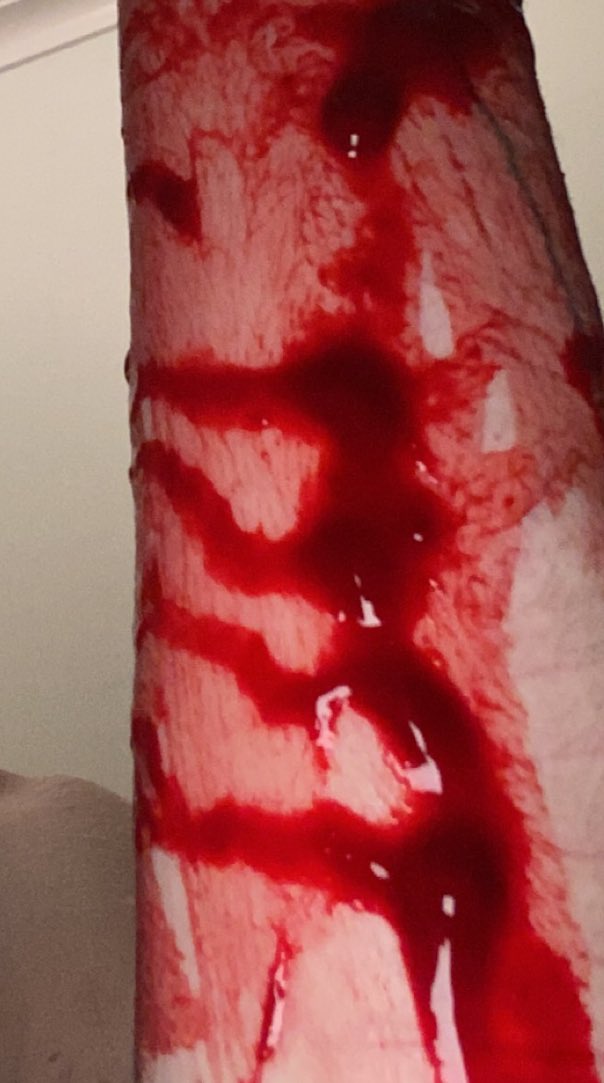 braiinisdead's tweet photo. trigger warning - self harm. no wounds are showing, just the blood :D 

♡

also in the last photo u can see a heartt

♡ https://t.co/KLLHYf8nFo