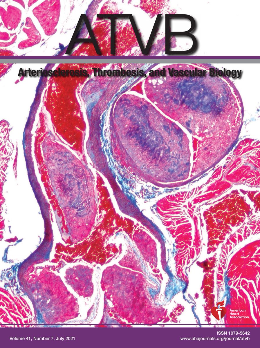 Our recent manuscript showing YAP1 drives epithelioid hemangioendothelioma is published as the Cover story of July 2021 issue of @atvbahajournals @UMassMedical Wonderful collaboration with @UMassMedMCCB @umassmemorial ahajournals.org/doi/10.1161/AT…