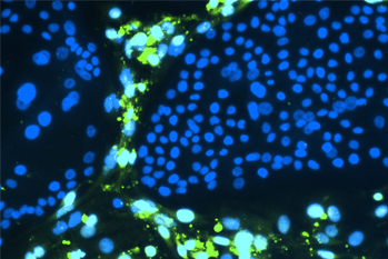 officialatcc's tweet photo. Today we announced the expansion of our collection of 2d & 3D patient tissue-derived in vitro #cancer models, part of our renewed partnership with @theNCI & @NIH to support the Human Cancer Models Initiative. Full press release: https://t.co/MdGjhiA8HB
#HCMI #cancerresearch https://t.co/pw5ywXgfvL