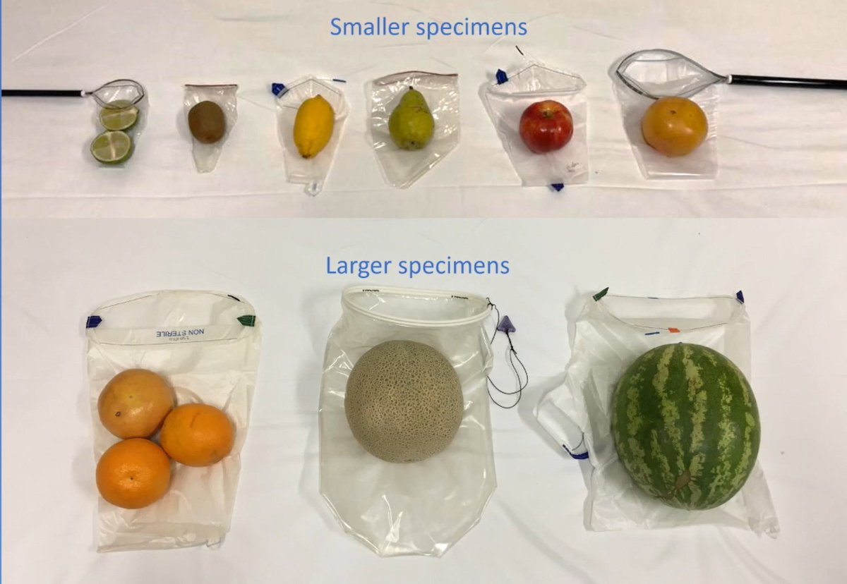 Liz Miazga (@lizmiazga) on Twitter photo Bag rage during laparoscopic surgery is real. Check out our video on tips for laparoscopic specimen extraction and learn how to choose a bag based on your favourite fruit! youtu.be/JxTB5hpEBaM #ACSC
<a href="/SOGCorg/">SOGC</a> <a href="/EliShoreMD/">Eliane Shore</a> <a href="/DebRobertsonMD/">Deborah Robertson</a> <a href="/SamBenloloMD/">Samantha Benlolo</a> @AndreaSimpsonMD <a href="/ANensiMD/">Alysha Nensi</a> Bag rage during laparoscopic surgery is real. Check out our video on tips for laparoscopic specimen extraction and learn how to choose a bag based on your favourite fruit! youtu.be/JxTB5hpEBaM #ACSC
<a href="/SOGCorg/">SOGC</a> <a href="/EliShoreMD/">Eliane Shore</a> <a href="/DebRobertsonMD/">Deborah Robertson</a> <a href="/SamBenloloMD/">Samantha Benlolo</a> @AndreaSimpsonMD <a href="/ANensiMD/">Alysha Nensi</a>