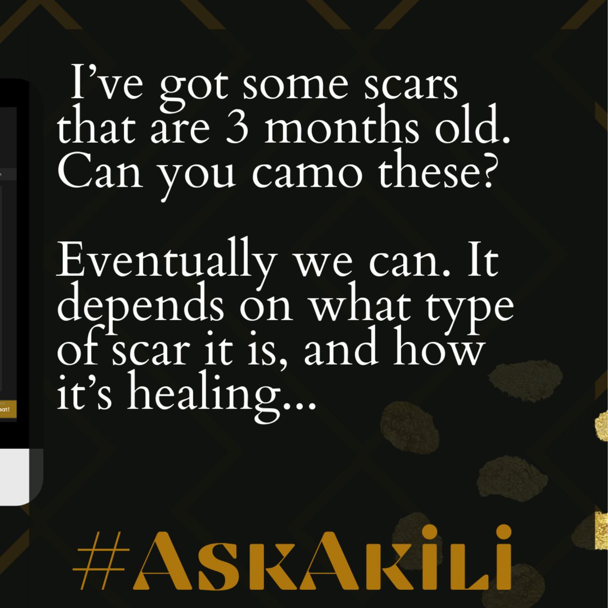 WorthyInkStudio's tweet photo. #AskAkili

Q: I've got some scars that are 3 months old. Can you camo these?

A: Eventually, we can. It depends on what type of scar it is, and how it's healing...

#scarcamouflage #WorthyInkStudio #ScarRevision https://t.co/tI9jstjr8l