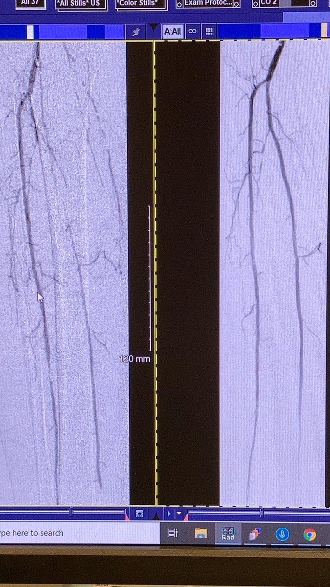 JParkMD's tweet photo. Before and after pic https://t.co/z294b3NBdR