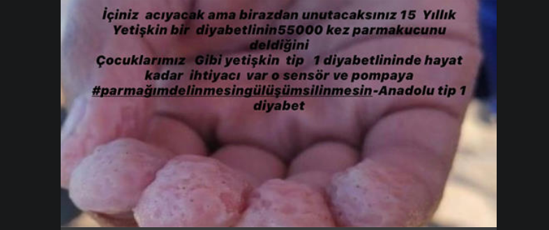 HERGÜN  DELİNİYORSA PARMAKLAR. UYKULAR HARAMSA . NÖBETTEYSE  AİLELER  .SENSÖR VE POMPA LüX DEĞIL ACiL iHTiYACTIR #parmağımdelinmesin <a href="/anadoludiyabet/">🇹🇷🇹🇷ANADOLUDİYABET🇹🇷🇹🇷ADANA</a>  <a href="/RTErdogan/">Recep Tayyip Erdoğan</a>  <a href="/omerrcelik/">Ömer Çelik</a> <a href="/HBTurkoglu/">Hacı Bayram TÜRKOĞLU</a> <a href="/drfahrettinkoca/">Dr. Fahrettin Koca</a> <a href="/sgksosyalmedya/">SGK</a> <a href="/deryayanikashb/">Derya Yanık</a> <a href="/DrRecepAkdag/">Recep Akdağ</a>