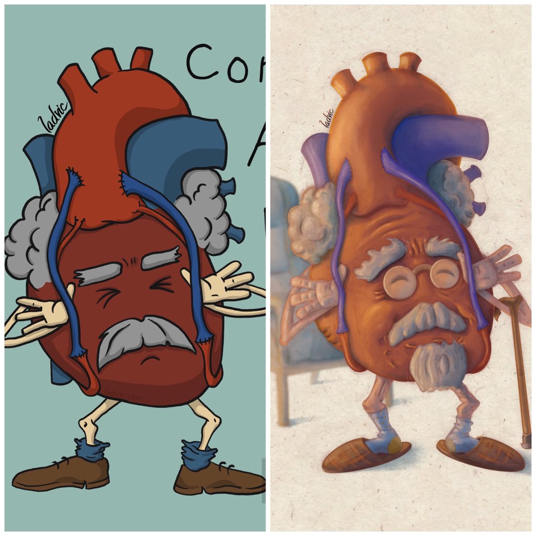 I have redrawn an old cartoon about cardiac bypass. 

#cardiac #bypass
