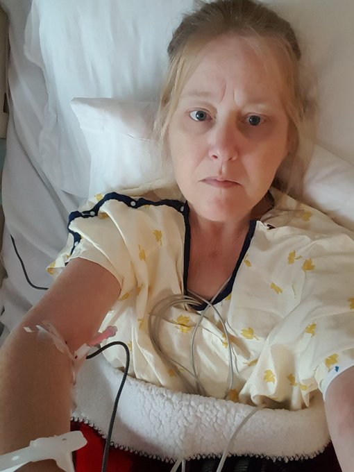 No filters just stark reality.  Hooked up,  wired for sound.  Catheter tube in my chest next to my heart<a href="/tag/mysteryalienfluid"class="tags"><span>#mysteryalienfluid</span></a>