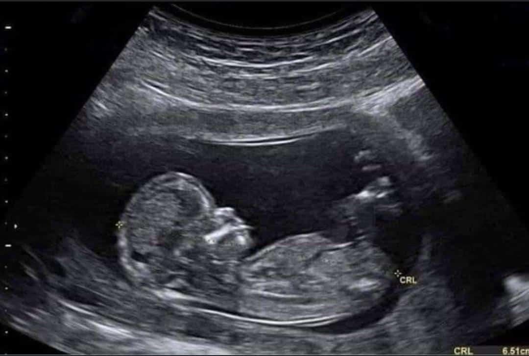 Mood
آخر صوره ليا وأنا مرتاح نفسيا:😅😂