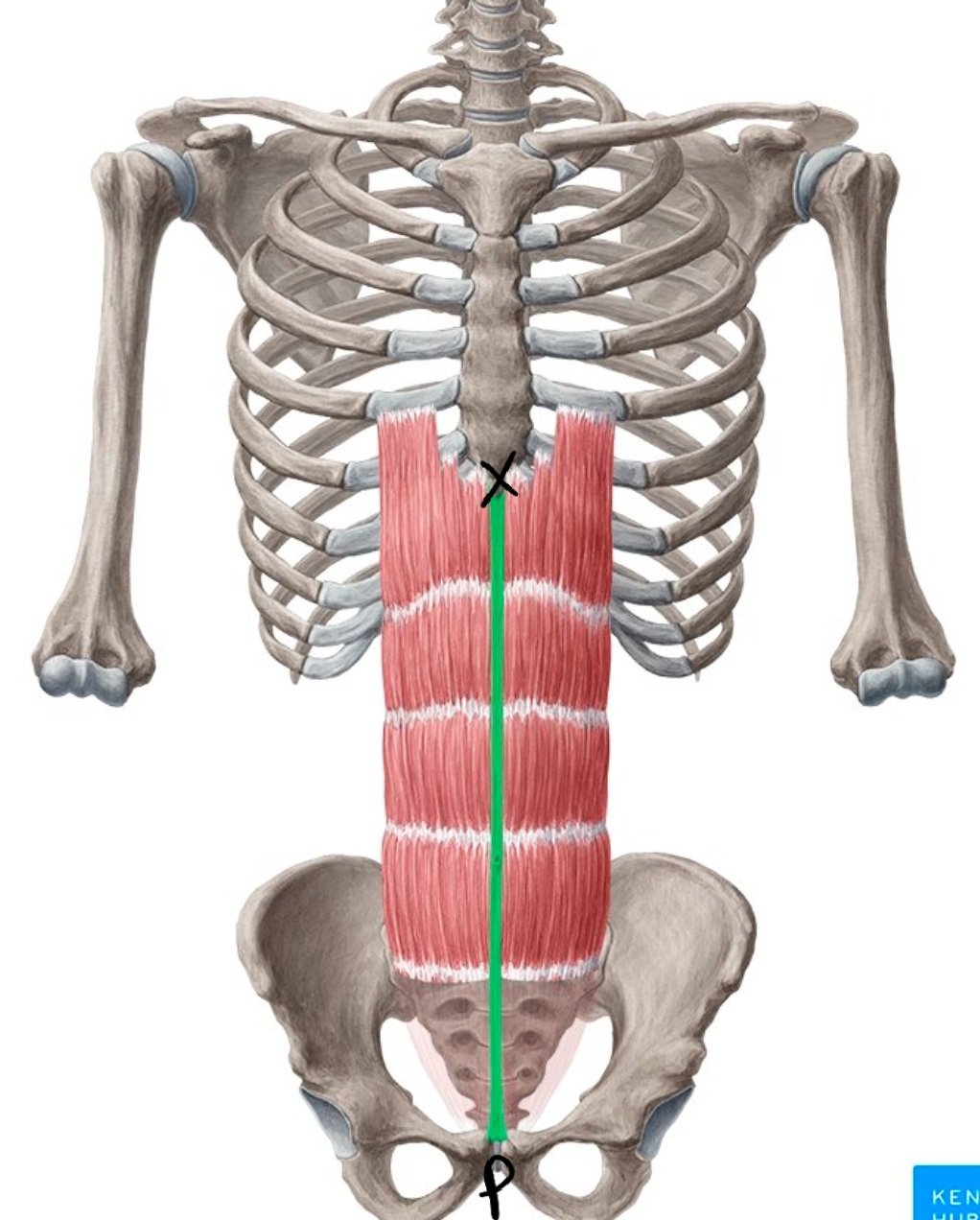 Pyramidalis muscle