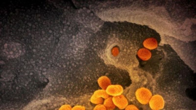 Only one new COVID case for entire South Zone, 73 provincially. #YQL #LNN #COVID19 #Alberta #Lethbridge 
lethbridgenewsnow.com/2021/06/24/onl…