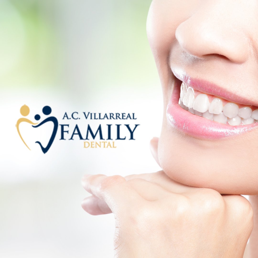 With the advanced teeth whitening options offered at A.C. Villarreal Family Dental, you can transform the look of your smile in as little as one office visit! #TeethWhitening #CosmeticDentistry #RGVdentist