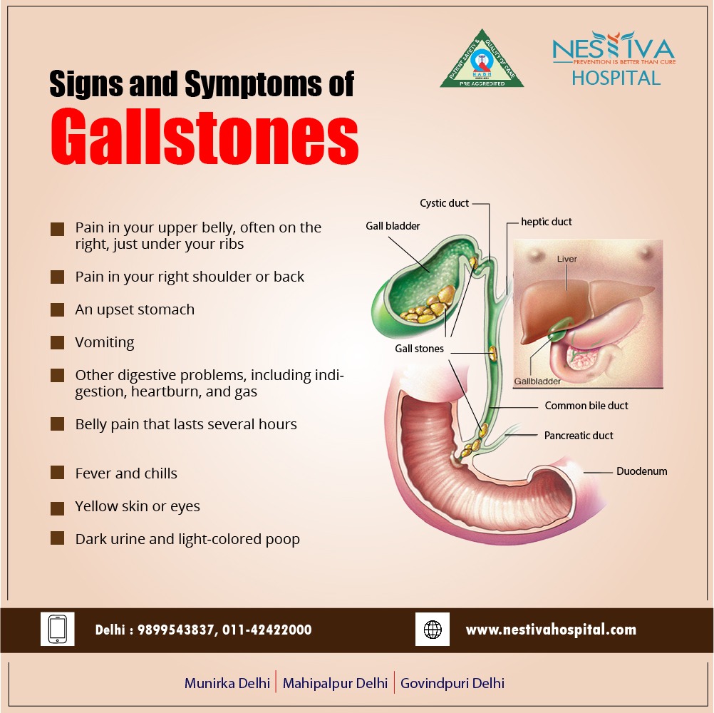 gallbladder stones symptoms