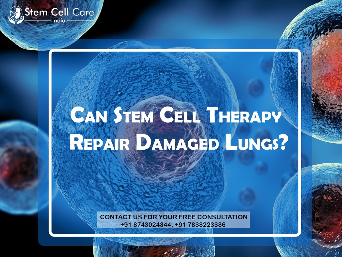 StemCellCare's tweet photo. Can Stem Cell Therapy Repair #DamagedLungs?
To know more about Damaged Lungs, visit https://t.co/UAO0Yl8dbF
#organspecific #regenerativemedicine #medical #staysafe #healthandsafety #biotech https://t.co/UX55Nc6o0A