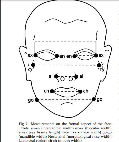 Using the great 2005 Farkas paper on skull measurements I threw together a littl user guide on how to distinguish certain ethnic groups from their close neighbors. These are the major anatomical landmarks and you can read the paper here:  http://femininebeauty.info/farkas.pdf 