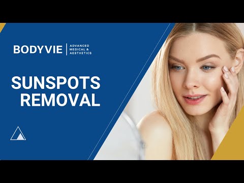 Sunspots laser removal treatment in Richmond - Bodyvie