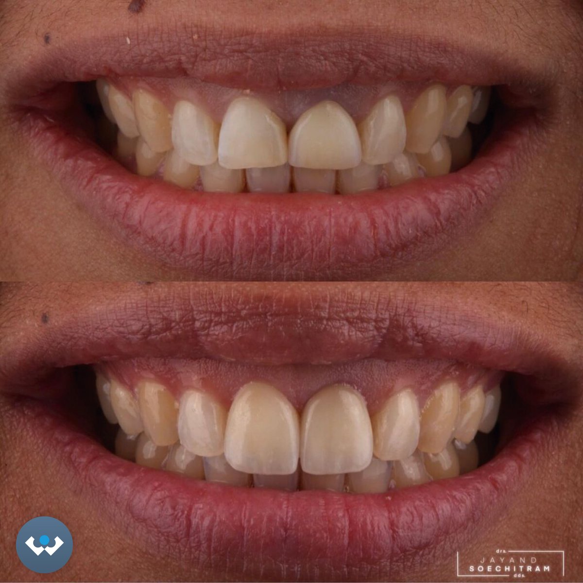 Excent Tandtechniek tweet media