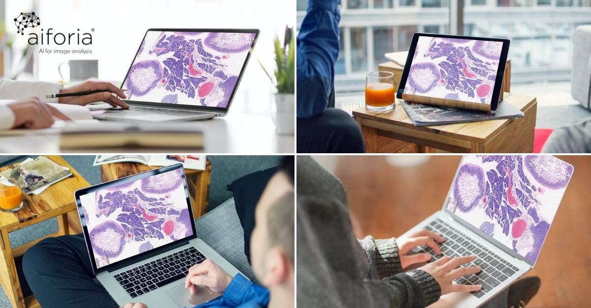 The USCAP Annual Meeting was a fully virtual event this year for the first time in its history. USCAP chose Aiforia to host the virtual pathology slides enabling 6,500 registrants access to educational content. Explore Aiforia’s cloud platform: aiforia.com/education