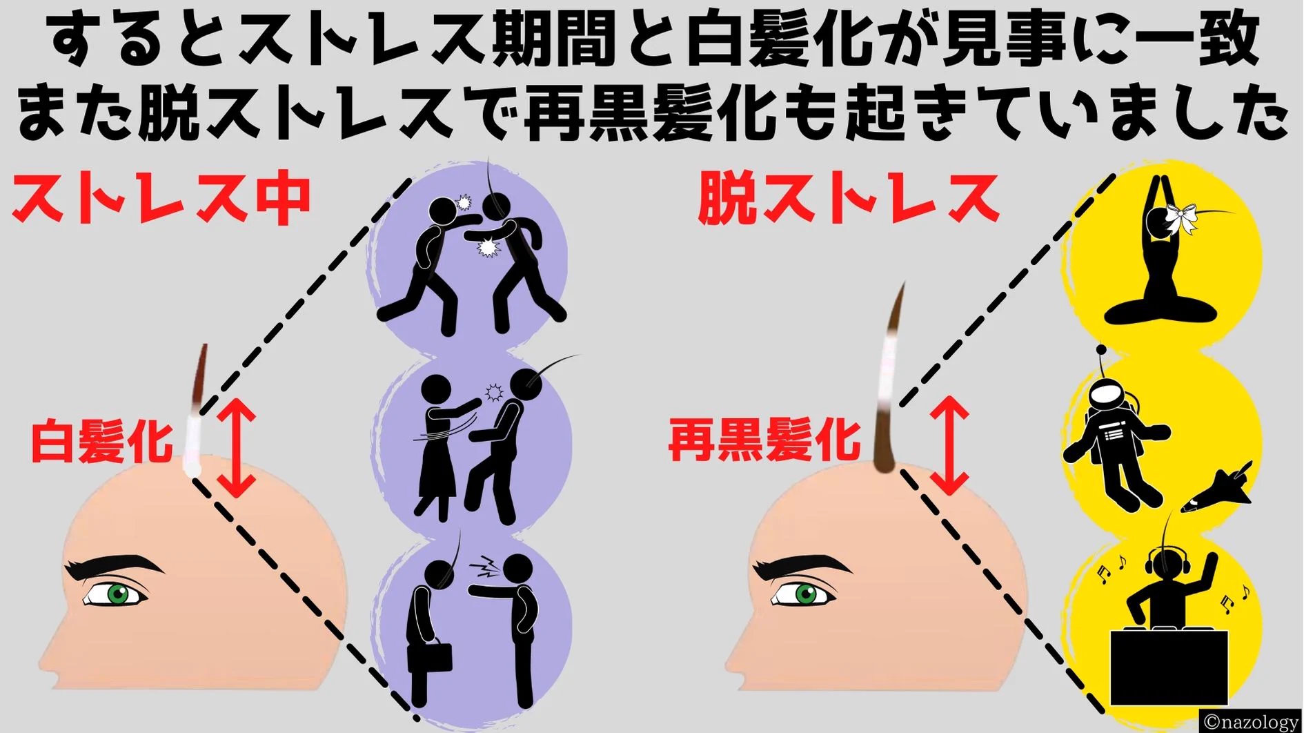 ストレスが原因だった！？脱ストレスによって白髪は元に戻ることが判明！