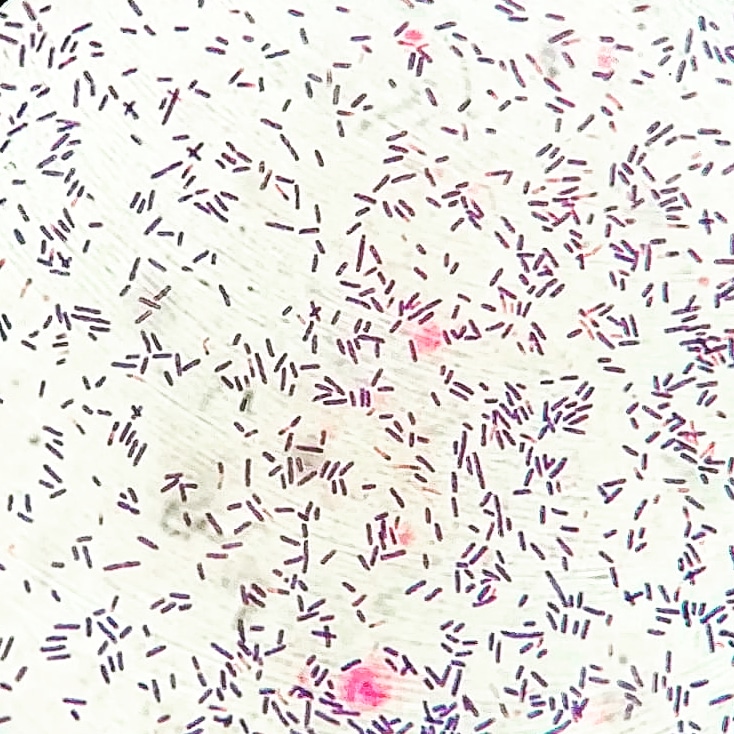 Clostridium Difficile Gram Stain