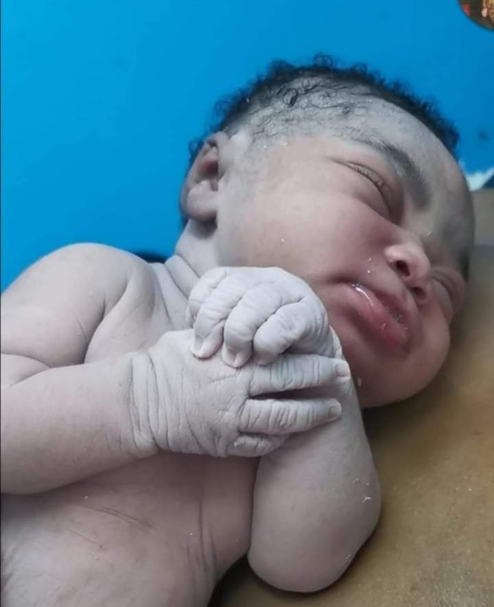 stevemoukam's tweet image. #InfluenceForHealth
#MinuteDrMoukam

Chers parents,  Savez-vous qu'à la naissance de votre bébé de sexe masculin, un testicule ou les deux peuvent être absents dans les bourses. ⛳️

On parle de #Cryptorchidie ou de d'#ectopie testiculaire ( un des testicules n'est pas à
⤵️