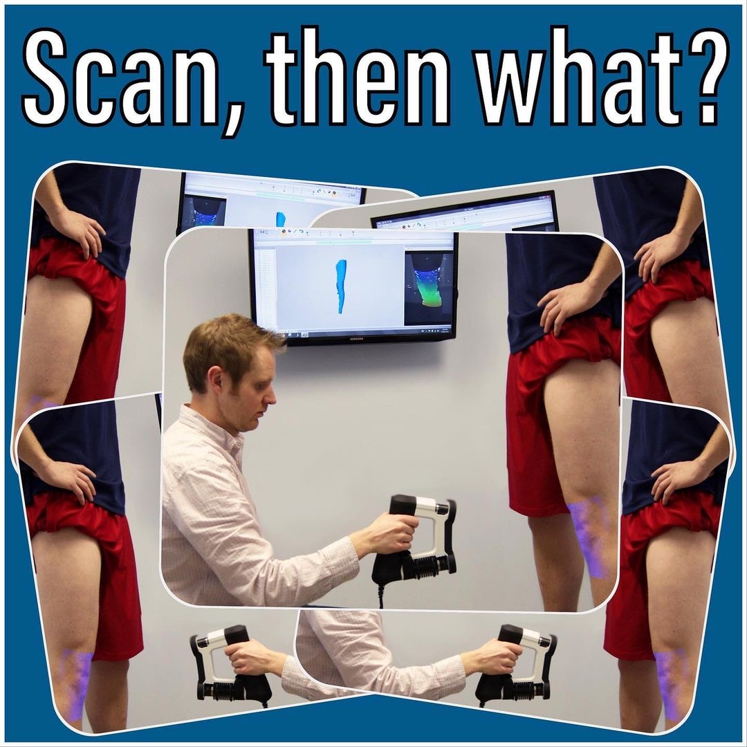 VorumResearch's tweet photo. Scan, modify, carve: a great illustration from Karl Hager Limb &amp; Brace about what goes into every custom knee brace!

#technology #prepregcarbon #kneebrace #orthotics #prosthetics #orthoticsandprosthetics #prótesis #órtesis #oandp #pando #computeraideddesign #Vorum https://t.co/Y8tAak2Amh