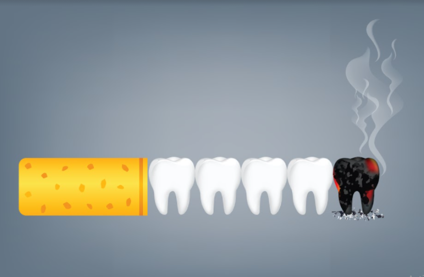 MWOrthodontics's tweet photo. Smoking increases the risk of oral health problems, including oral cancer.

But how exactly does smoking affect your smile?

Here are the major oral health problems that tobacco use can cause. How do dentists help reduce the potential damage?
📘 https://t.co/YOuq1WCXUx https://t.co/I63YMvoN0J