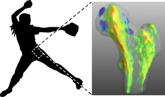 Stuart Warden, PT, PhD, FACSM, FASBMR (@stuartjwarden) on Twitter photo Our new study maps proximal femur adaptation to physical activity using softball pitchers as a within-subject controlled loading model. The axial loading and resulting adaptation can influence strength to a sideways fall - <a href="/KershTBL/">Mariana Kersh, PhD</a>
sciencedirect.com/science/articl… Our new study maps proximal femur adaptation to physical activity using softball pitchers as a within-subject controlled loading model. The axial loading and resulting adaptation can influence strength to a sideways fall - <a href="/KershTBL/">Mariana Kersh, PhD</a>
sciencedirect.com/science/articl…