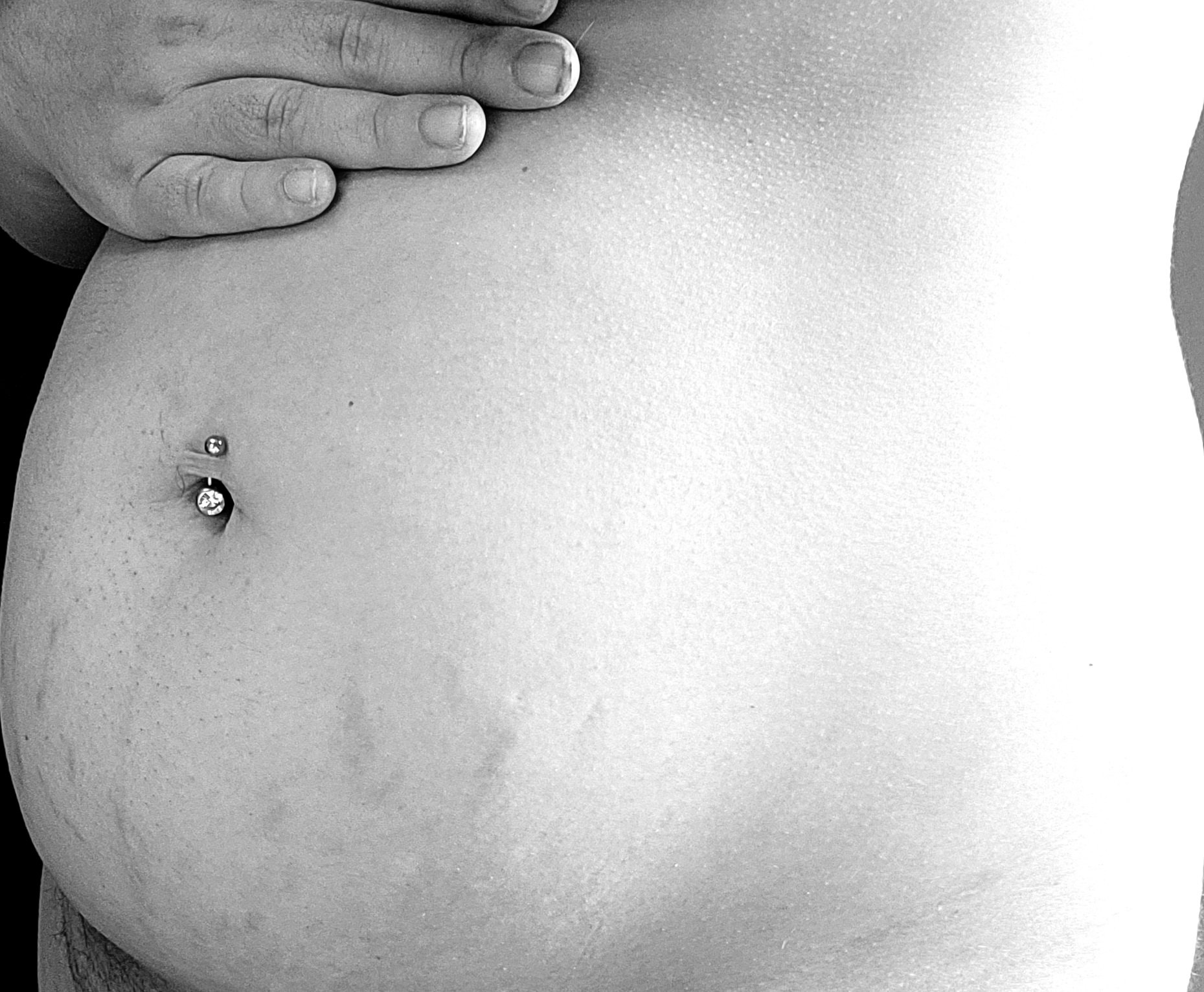 1 pic. #2monthspostpartum #stretchmarks #normalize #bodyimage @lynnstarina https://t.co/I1ZZJpSXn0