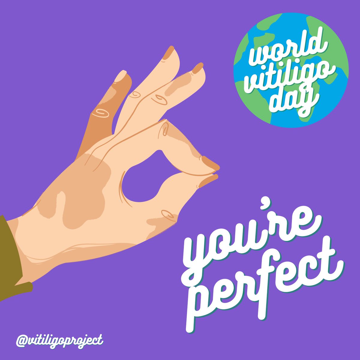 Vitiligo Project tweet media