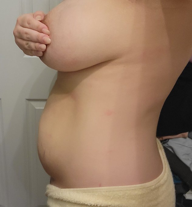 #pregnancy #pregnantonlyfans #pregnancyjourney #postpartum #normalize #bodychange #bodyimage #life #love<a href="/tag/pregnancy"class="tags">#pregnancy</a><a href="/tag/pregnantonlyfans"class="tags">#pregnantonlyfans</a><a href="/tag/pregnancyjourney"class="tags">#pregnancyjourney</a><a href="/tag/love"class="tags"><span>#love</span></a><a href="/tag/life"class="tags"><span>#life</span></a><a href="/tag/bodyimage"class="tags"><span>#bodyimage</span></a><a href="/tag/postpartum"class="tags"><span>#postpartum</span></a><a href="/tag/bodychange"class="tags"><span>#bodychange</span></a>