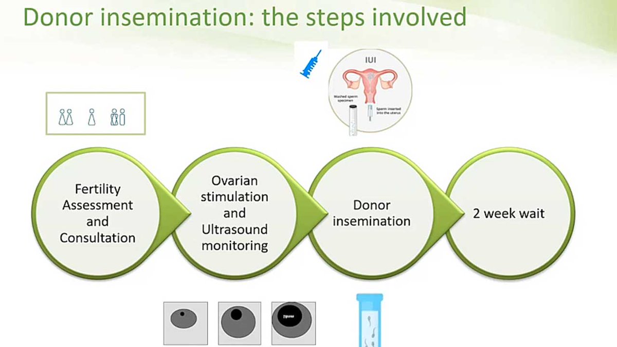 A very common question single women, and women in a same sex relationship, ask is: "should I opt for donor Insemination or IVF?"
In the video below, Dr. Carole Gilling-Smith and George Koustas, from the Agora Clinic in Sussex, go through the key

agoraclinic.co.uk/donor-insemina…