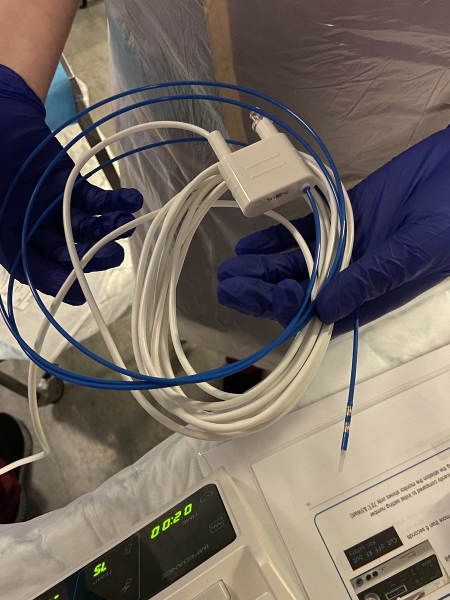 GiorgiaAla's tweet photo. Incredible case with Dr Terry Wong (⁦@wongter1⁩) at St. Thomas’ hospital (⁦@GSTTnhs⁩)❗️
#Endobiliary #RFA and then bi-lobar stenting with a #StentThroughStent procedure (⁦@taewoongmedical⁩ #ELRA and #LCD - all distributed in UK by us, ⁦@AquilantGI⁩

PART 1 https://t.co/Z3TSUsRMcL