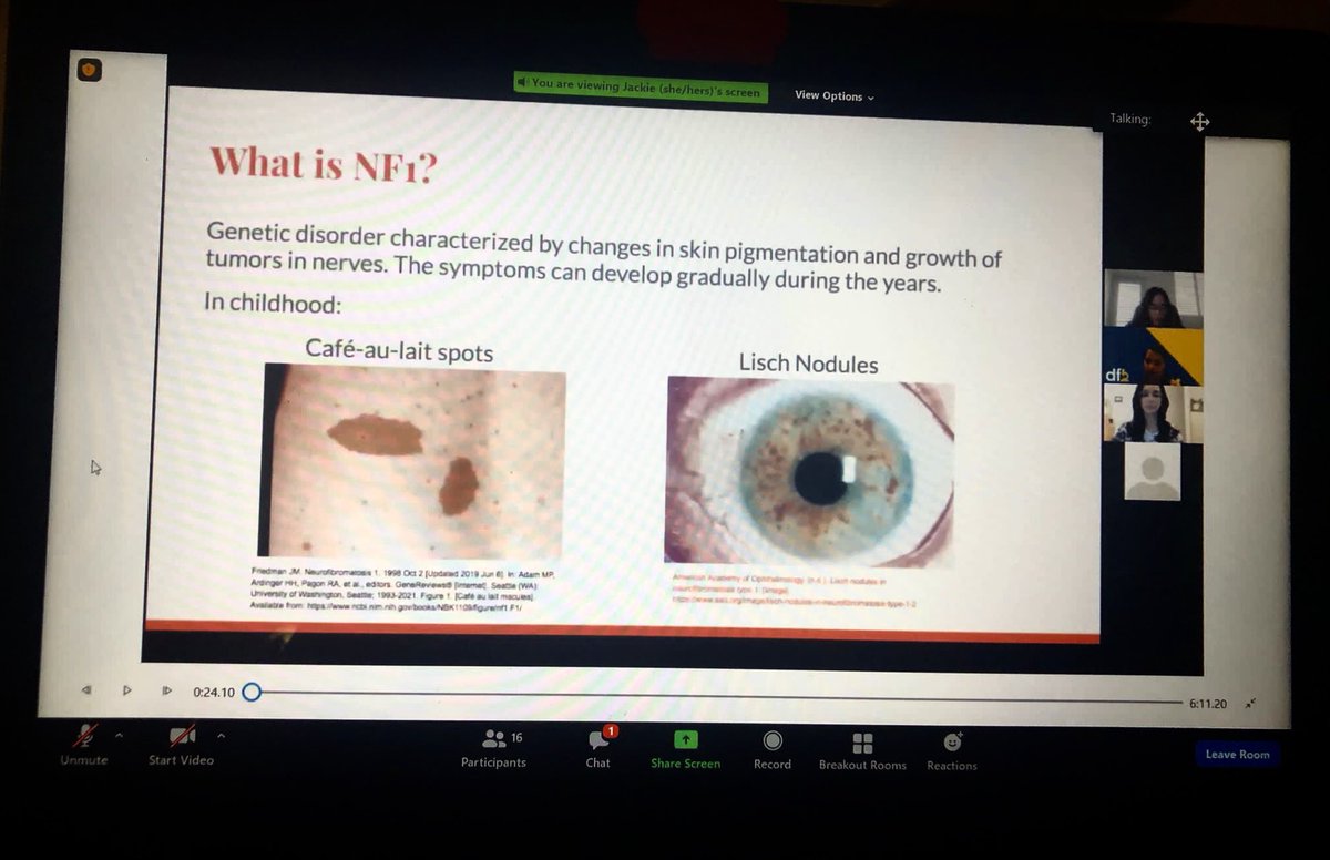 DFB_UM's tweet photo. Today we had our last student presentations and we learned a lot about Neurofibromatosis! Great job Team AMPK, Team Hedgehog & Team Chico! 👏🏼 #DFB2021 https://t.co/ggY1XMaVuT