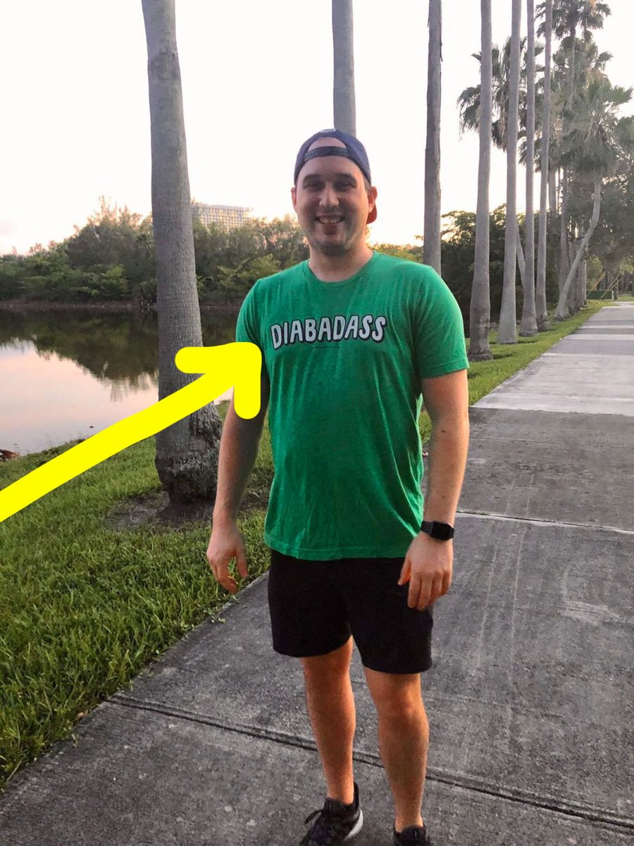 thediabeticsurv's tweet photo. 🏃♂️☀️🇺🇲 Thank you, Matt (@stockermd) for this great DIABADASS pic from Florida!
#diabadass #typeonediabetes #typeonediabetic #showmeyourpump #typ1family #öppendiabetes #beatdiabetes #diabetestyp1 #canadiandiabetesassociation #americandiabetesassociation https://t.co/9bO9MwHmuo