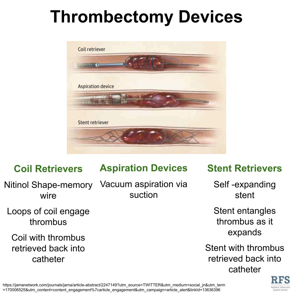 SIR RFS on Twitter "Various devices can be used for thrombectomy