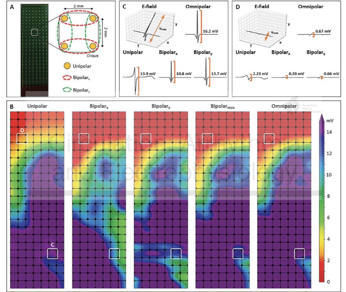 ShaojieChen1's tweet photo. Identification of Low-voltage Areas: Unipolar, Bipolar and Omnipolar, from van Schie et al., #circep #epeeps https://t.co/2lcJAgaAB8 https://t.co/MBZnd3pfh3