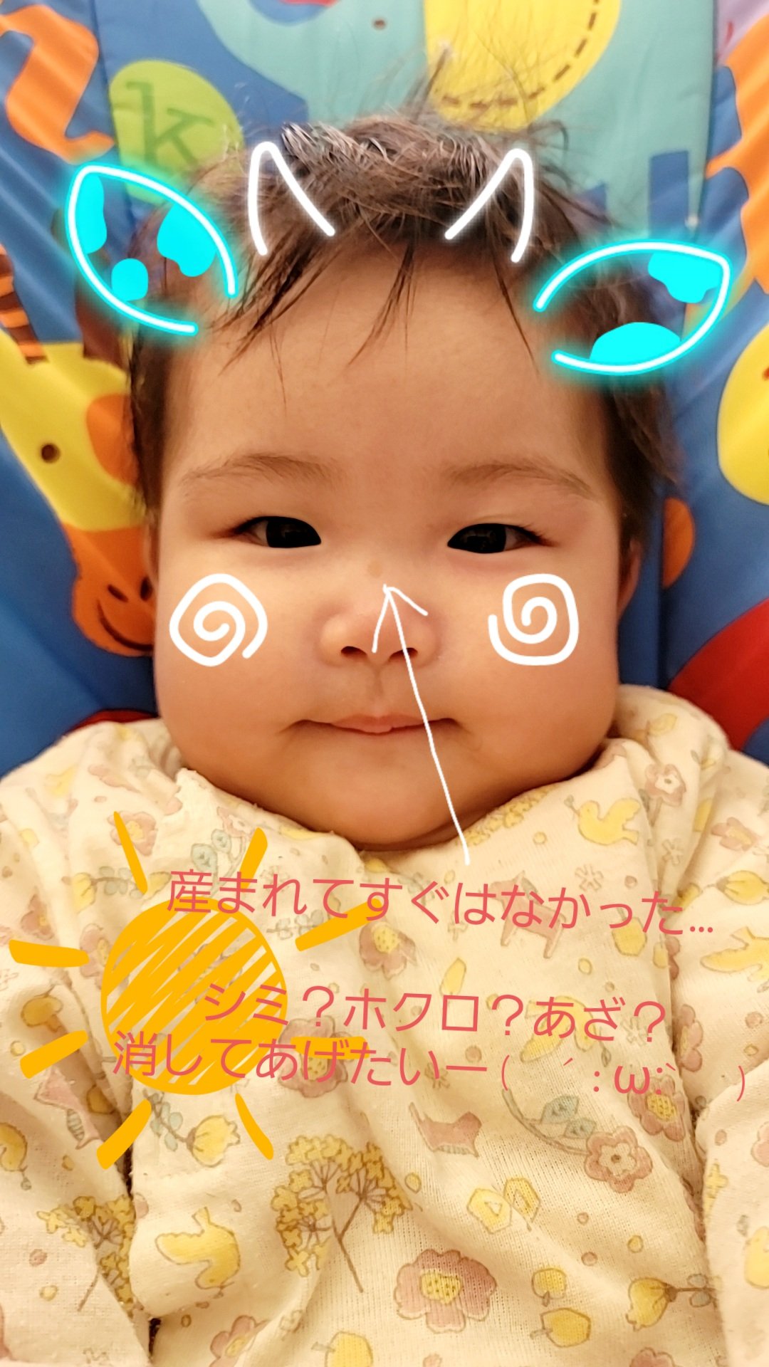 Twitter 上的 まろまゆさん 3ヶ月目位から目立ち始めたコレ なんだろうか 消してあげたいなー 大きくなるにつれて消えるかなぁ 悩むー 赤ちゃん シミ あざ ほくろ 生後 赤ちゃん相談室 レーザー治療 T Co Rr1nstzb Twitter