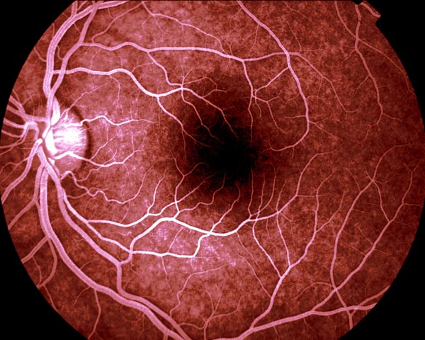 ArtBioCollab's tweet image. 🐚"Your #visualsystem is in some way hardwired to understand fractals...The stress-reduction is triggered by a physiological resonance that occurs when the #fractal structure of the eye matches that of the fractal image being viewed." #BioInspiration #ArtScience #FractalFriday