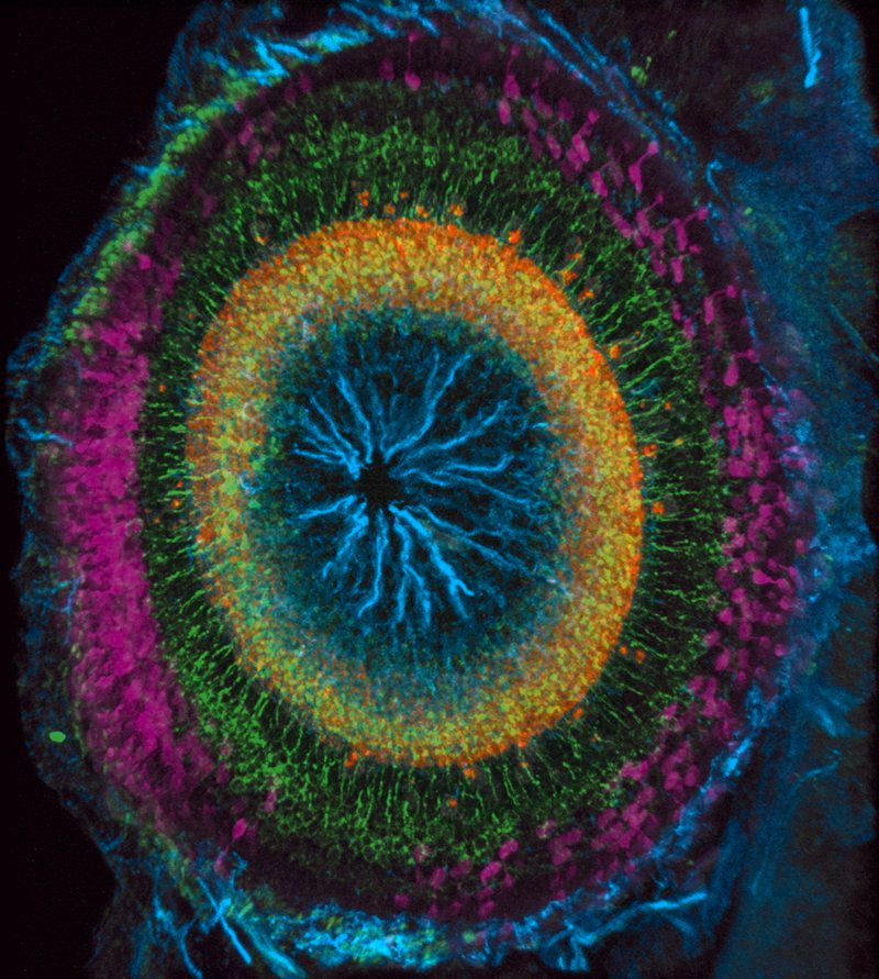 ArtBioCollab's tweet image. 🐚"Your #visualsystem is in some way hardwired to understand fractals...The stress-reduction is triggered by a physiological resonance that occurs when the #fractal structure of the eye matches that of the fractal image being viewed." #BioInspiration #ArtScience #FractalFriday
