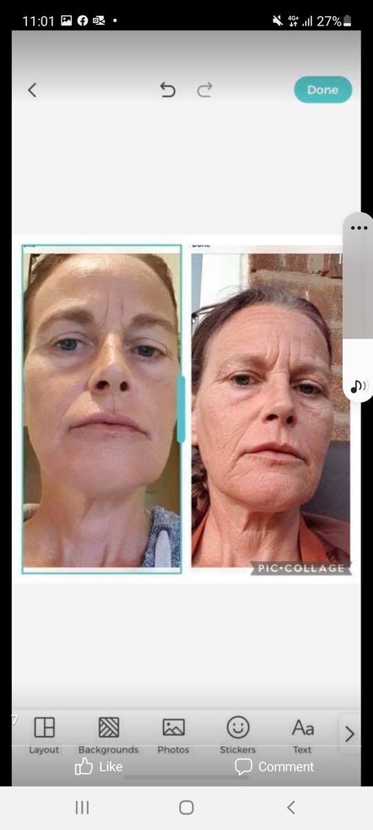 Lush dollz offers two fully trained practitioners inside with full consultation prior to all procedures and treatments with 1 to 1 client care and full after care advice with all treatments,.procedires we offer a clinic based premises with high  standards of cleanliness..
