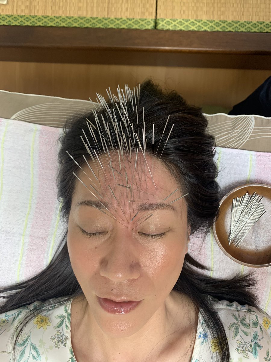 taisuke369's tweet photo. 脳を新品に入れ替え、思考や現実を動かす儀式。

この後のスッキリ感と言ったら🥰

#ルート治療
#ルート鍼 https://t.co/FJlt5sy3Re