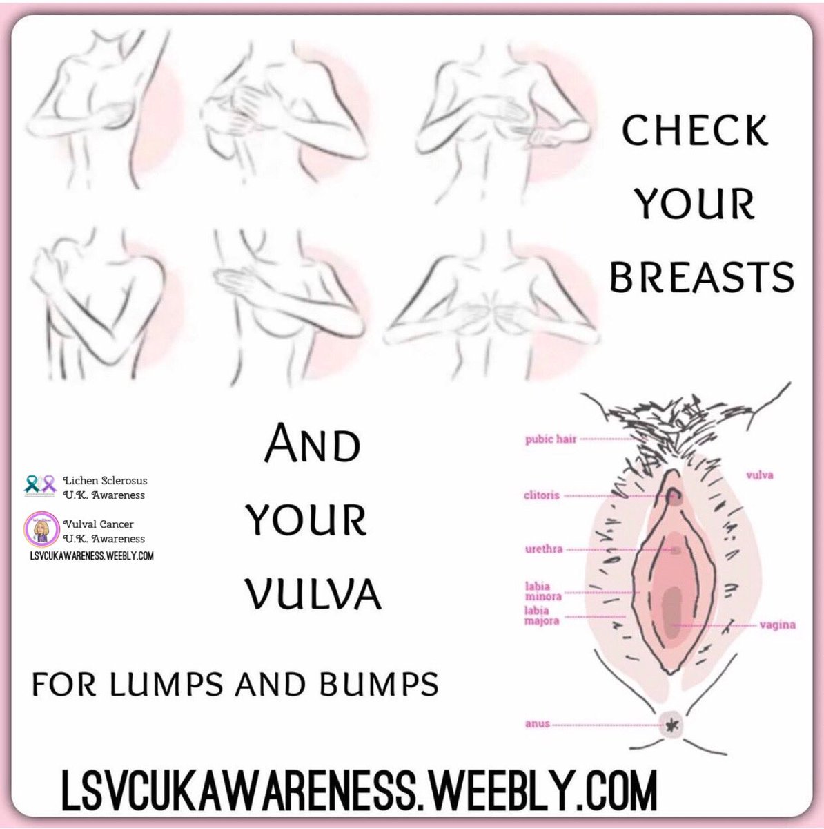 Vulval Cancer UK Awareness tweet media