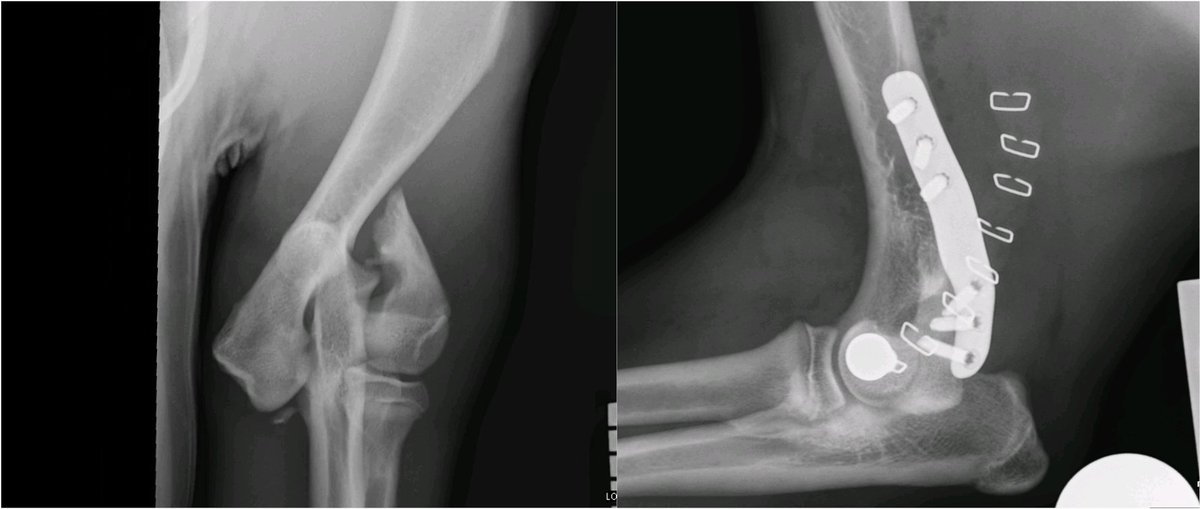 The Lateral Epicondylar Anatomical Plate from <a href="/FusionImplants/">Fusion Implants</a> is a great LEAP forwards. It makes repairing these fractures super-satisfying and provides a reliable locking plate construct for these dogs.